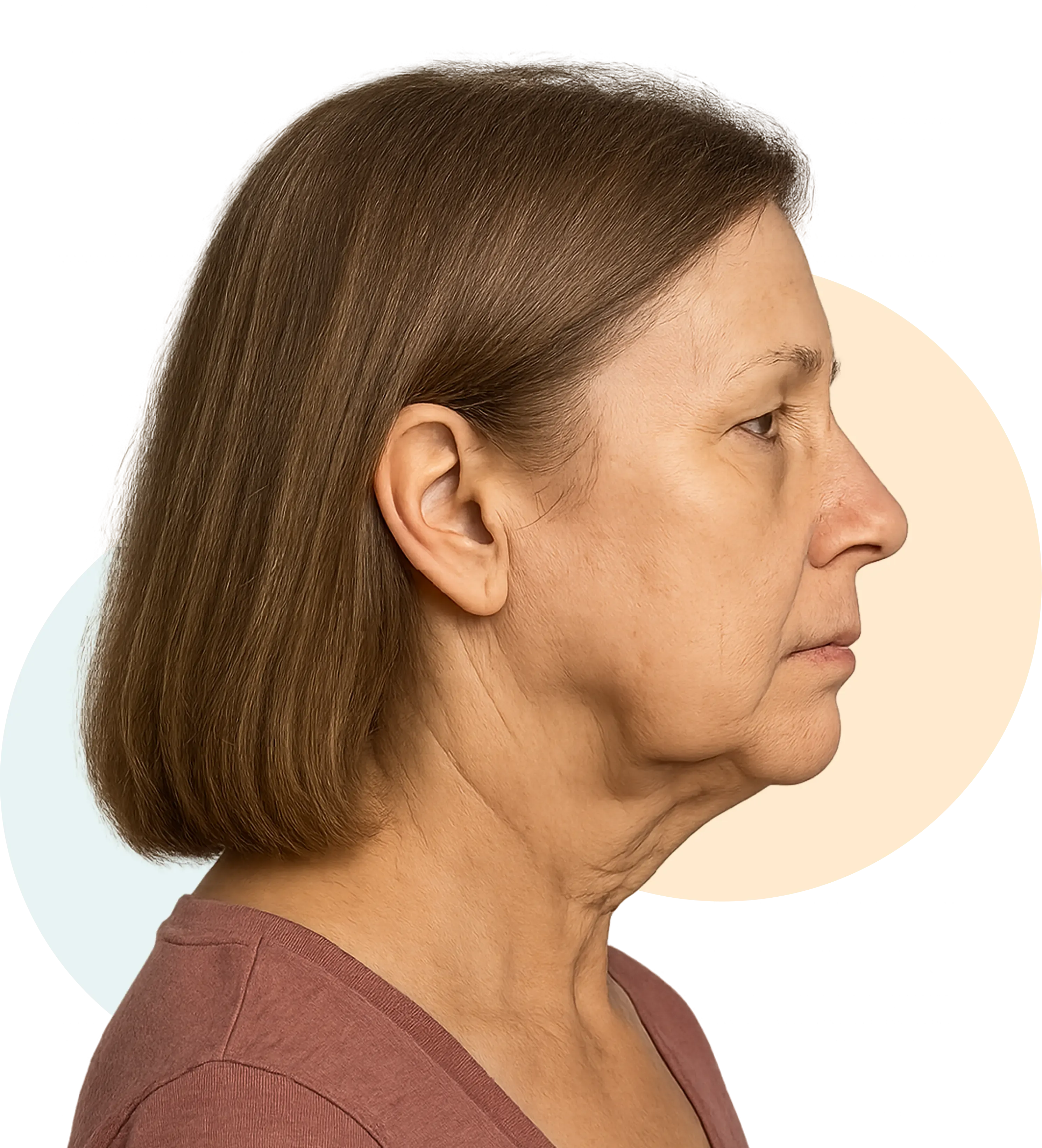 The 3 Reasons That Neck Skin Sags