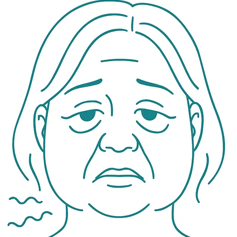 Woman with puffy eyes