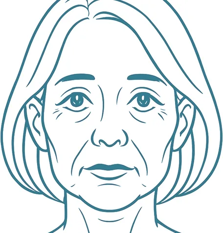 Woman with sagging eyes