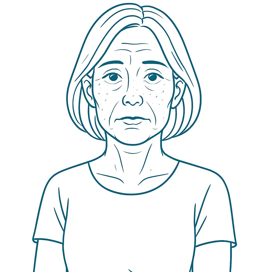 Fine Lines, Sagging, Dark Spots and Dryness