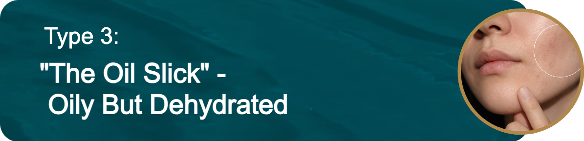 Type 3: "The Oil Slick" - Oily But Dehydrated